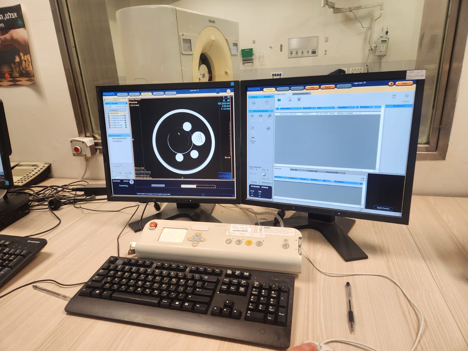 Philips Brilliance iCT 256 phantom acquisition during daily QC — preview on Philips operator console