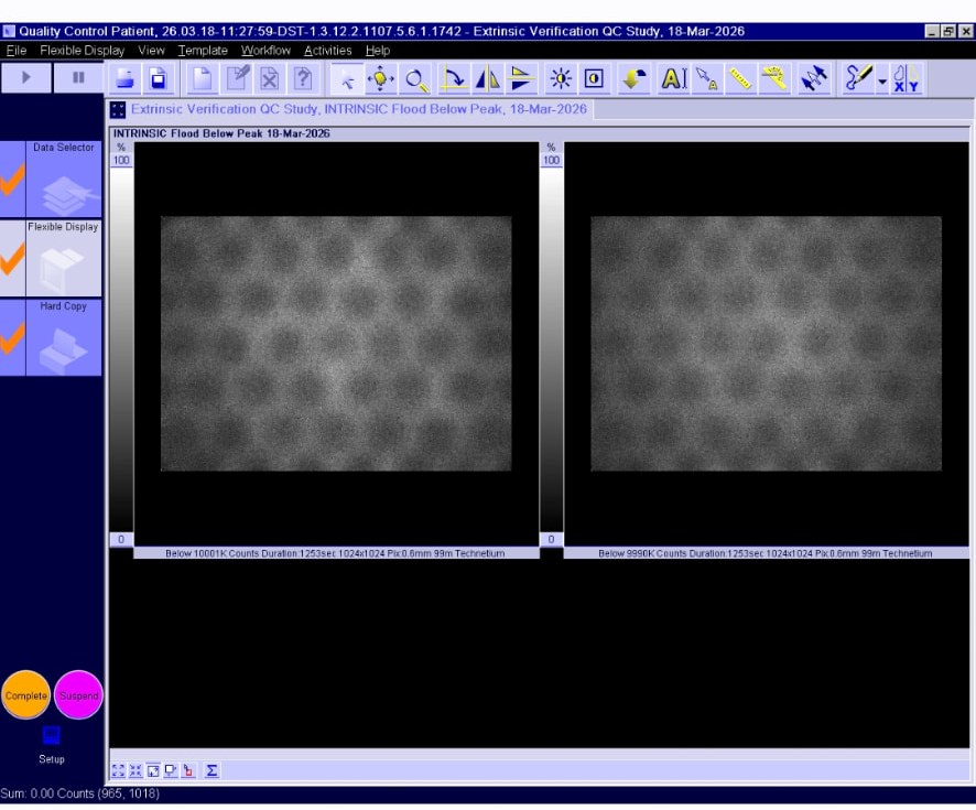 Siemens Symbia Evo Excel console screenshot — intrinsic flood below peak acquisition on both detectors showing no crystal defects, 18 March 2026