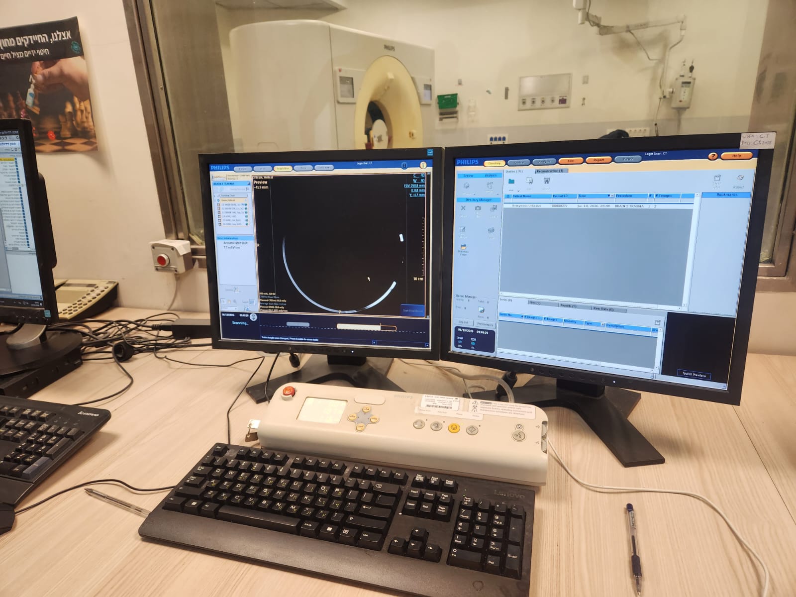 Philips Brilliance iCT 256 scout / topogram acquisition on operator console with gantry visible through control-room window