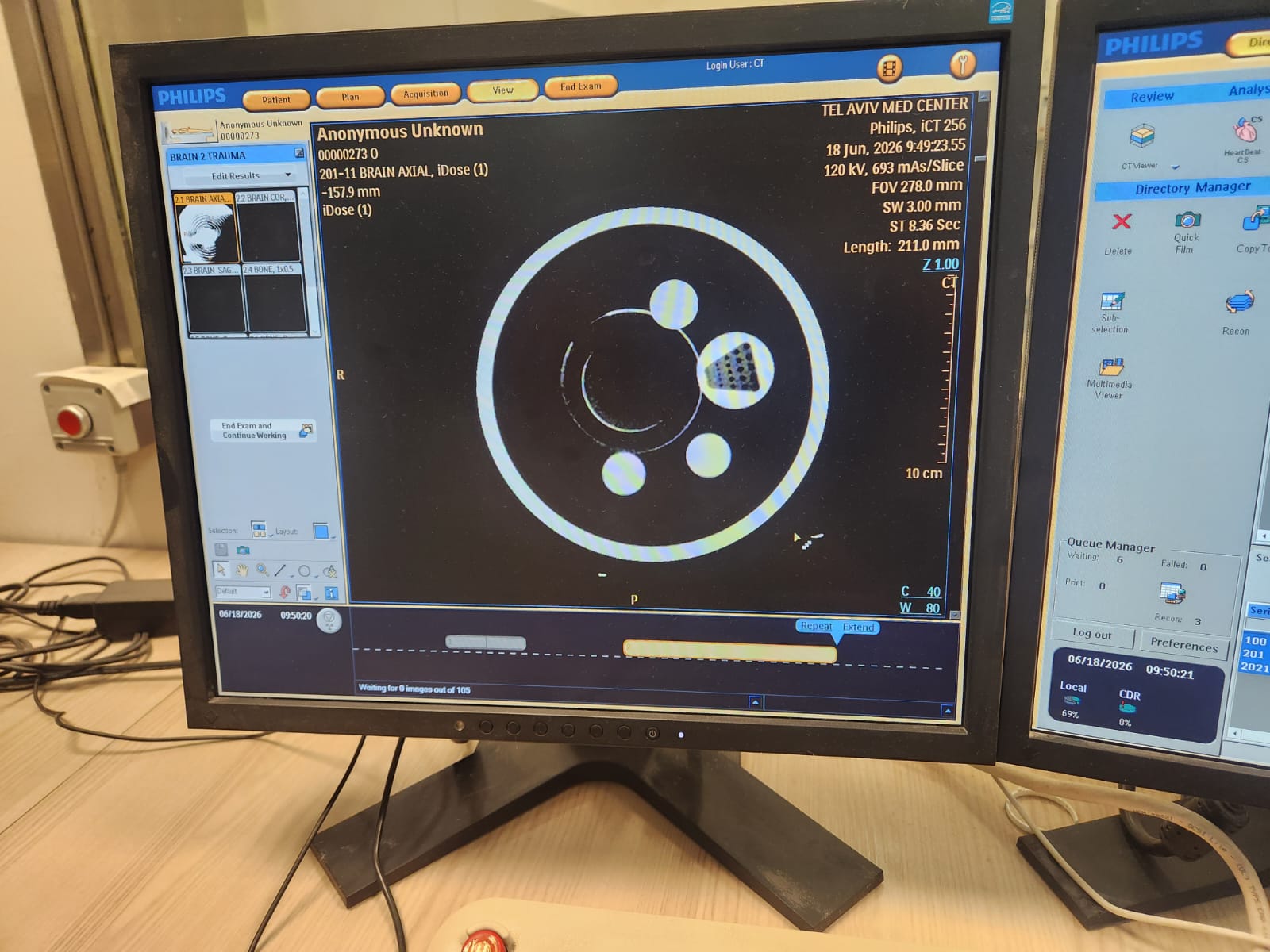 Philips iCT 256 operator console showing live BRAIN AXIAL acquisition — 120 kV, 693 mAs/slice, FOV 278 mm