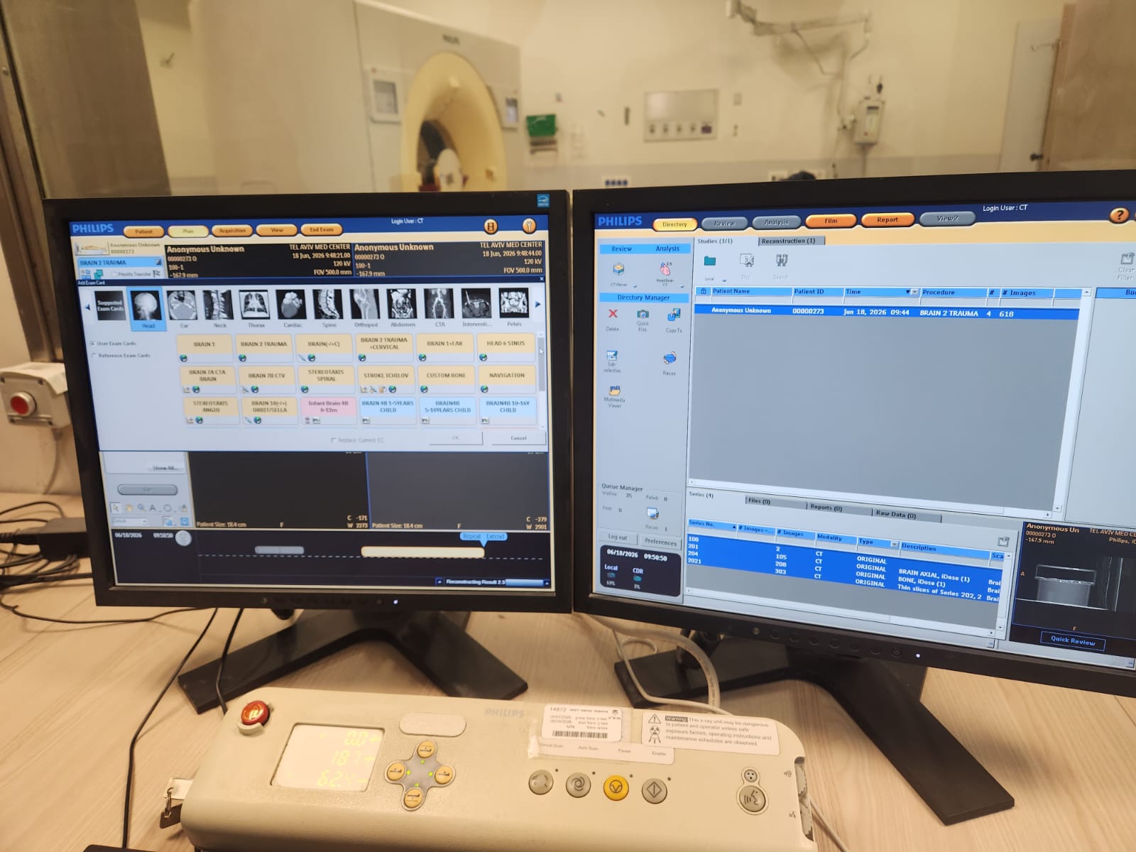 Philips iCT 256 Exam Card Manager showing full clinical protocol library — Brain, Cardiac, CTA, Stroke and pediatric protocols