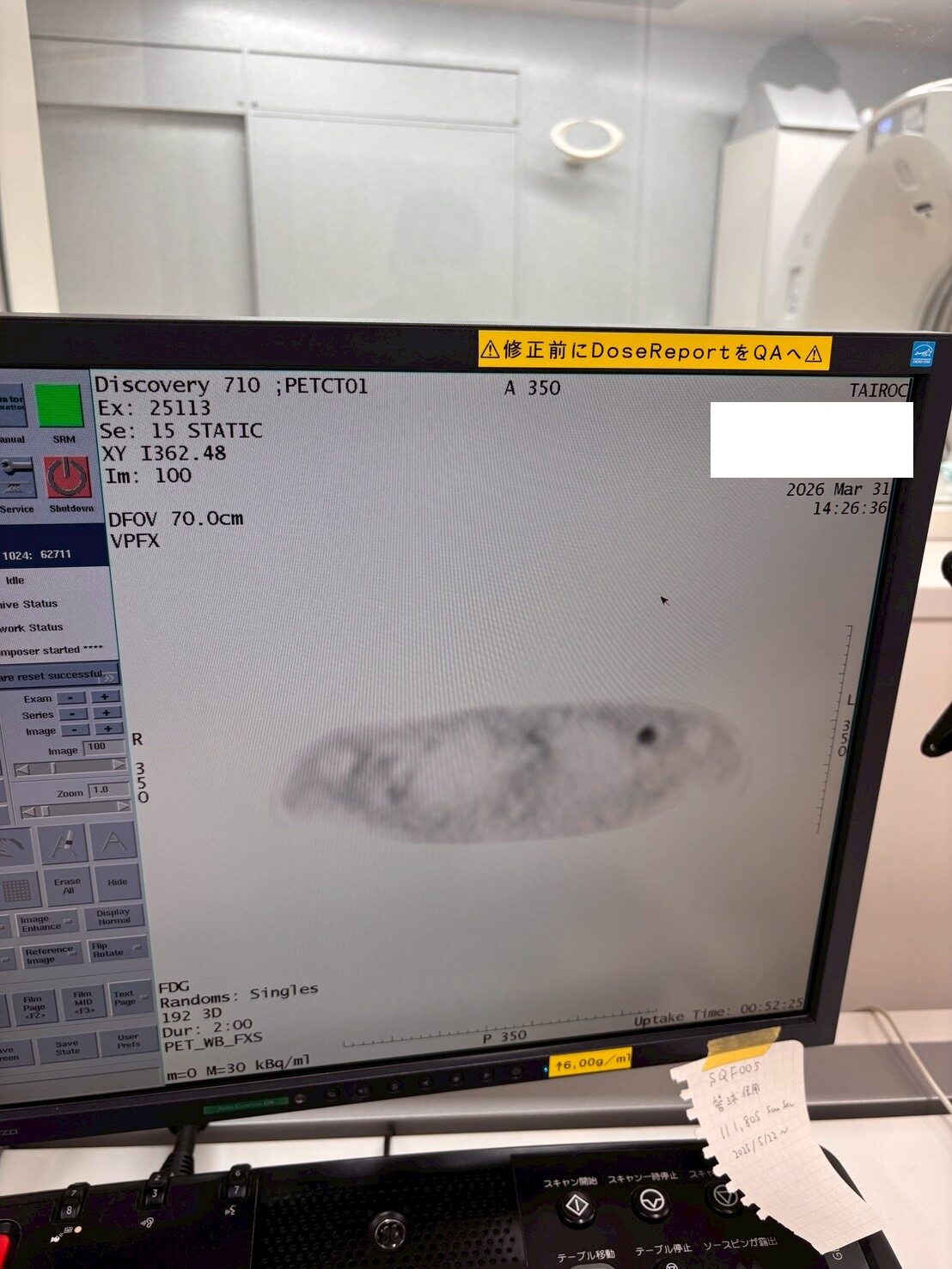 GE Discovery 710 PET daily QC phantom scan on operator console with gantry in background